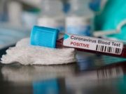 2 WNI Positif Corona, Masyarakat Cemas Sekaligus Kecewa ke Pemerintah