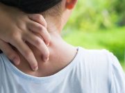 Kupas Tuntas Atasi Alergi Anak Bareng Siloam Hospitals Sentosa Bekasi