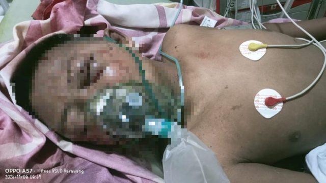 IMG-20251106-WA0000 Anak Disabilitas karawang